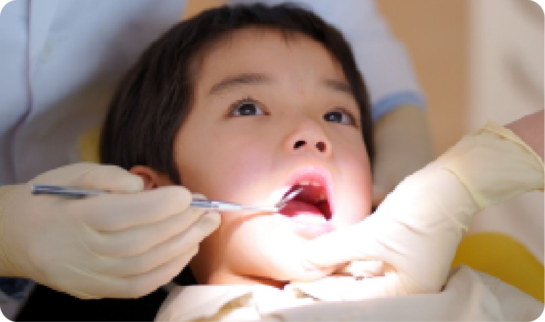 むし歯治療スタート